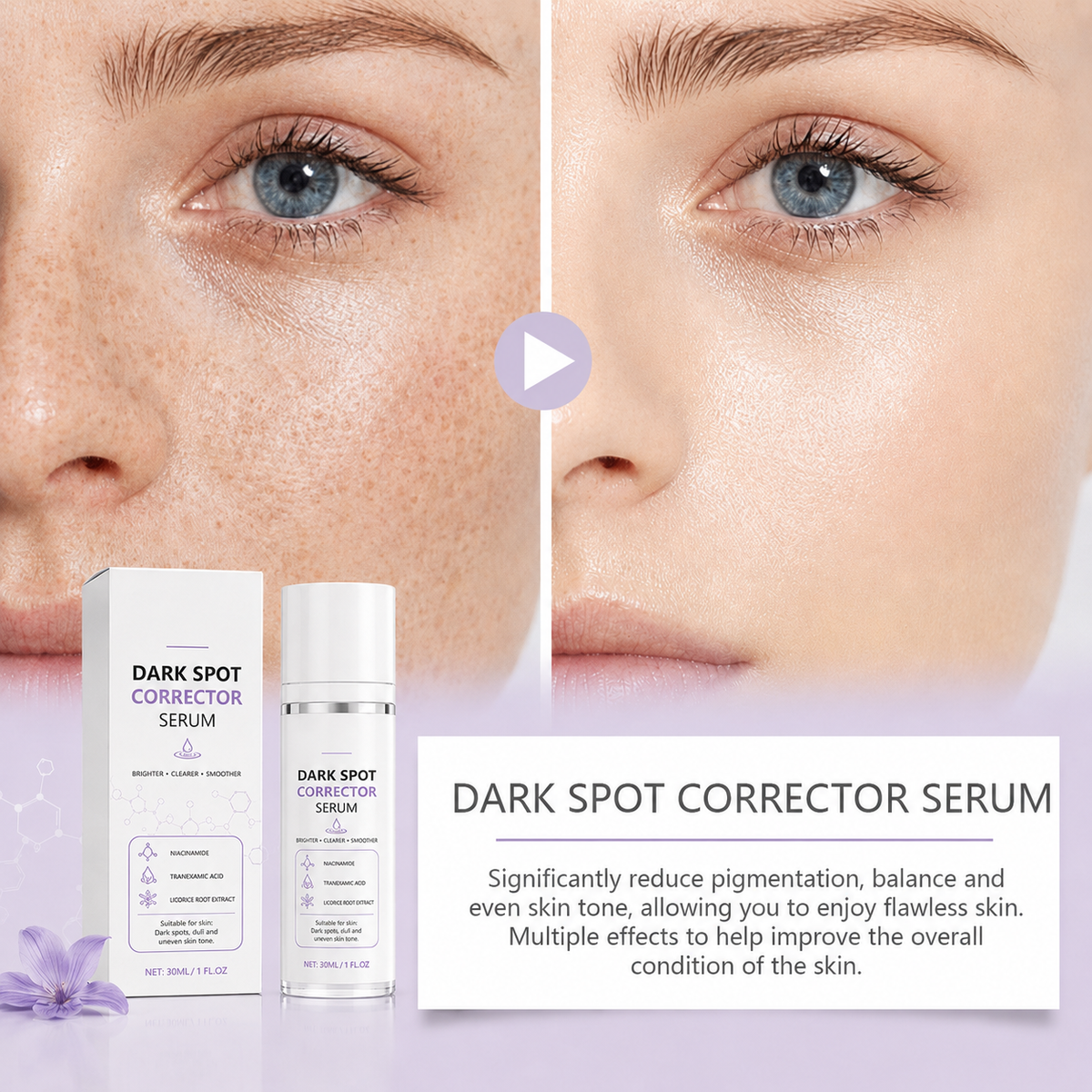 🔥Limited Time Offer🔥Advanced Dark Spot Corrector Serum -Multi-Correction Brightening Formulafor Sun Spots, Age Spots, and Melasma